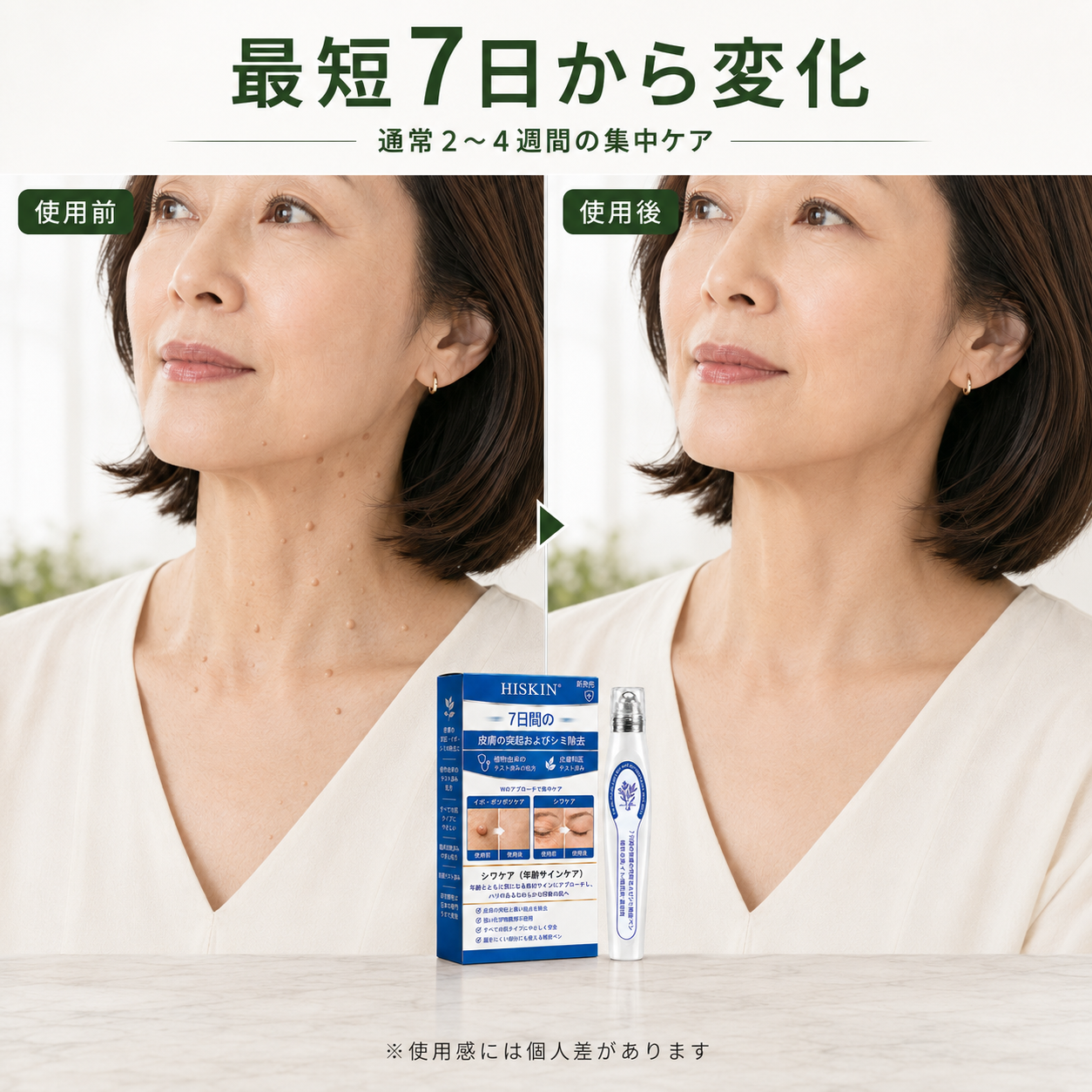 HISKIN® イボ除去ペン