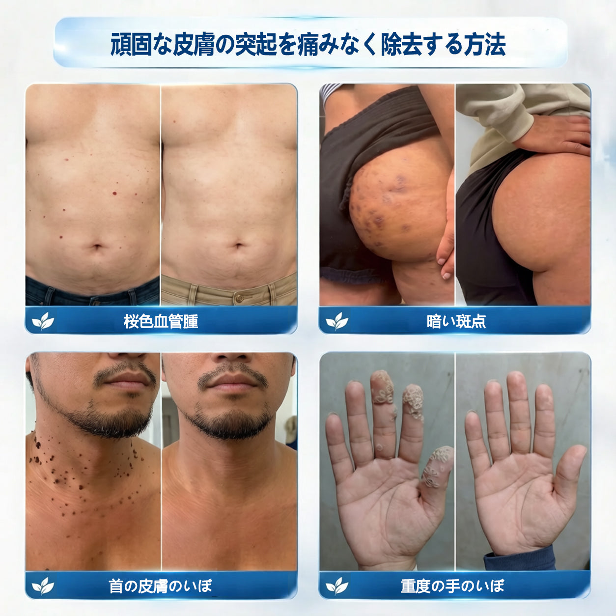 🎁 ご注文限定｜7日間ピンポイントケアローラー追加購入30％OFF