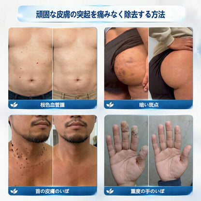 🎁 ご注文限定｜7日間ピンポイントケアローラー追加購入30％OFF
