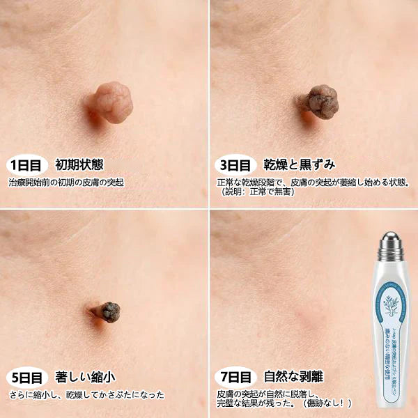 🎁 ご注文限定｜7日間ピンポイントケアローラー追加購入30％OFF