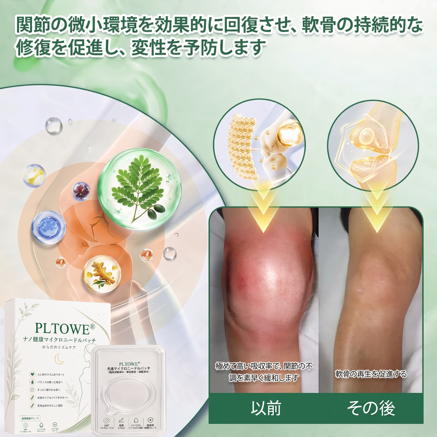 ✨ 今だけ30％OFF｜PLTOWE® マイクロニードルパッチを追加購入 🌿